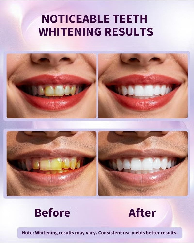SmileKit Purple Teeth Whitening Strips - product image 5